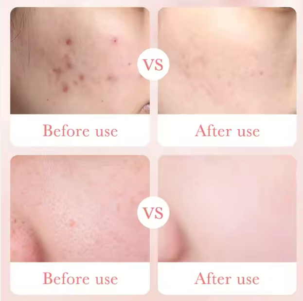 Crema Antiojeras Con Ácido Hialurónico